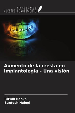 Aumento de la cresta en implantología - Una visión
