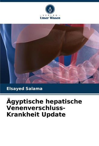 Ägyptische hepatische Venenverschluss-Krankheit Update
