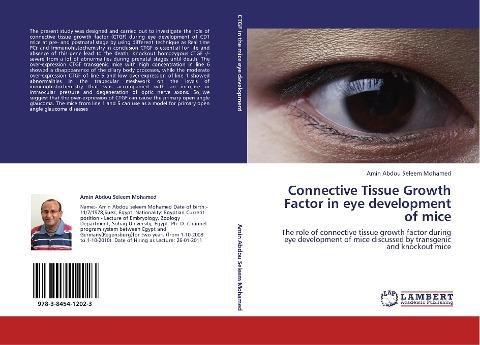 Connective Tissue Growth Factor in  eye development of mice