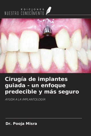 Cirugía de implantes guiada - un enfoque predecible y más seguro