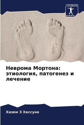 Newroma Mortona: ätiologiq, patogenez i lechenie