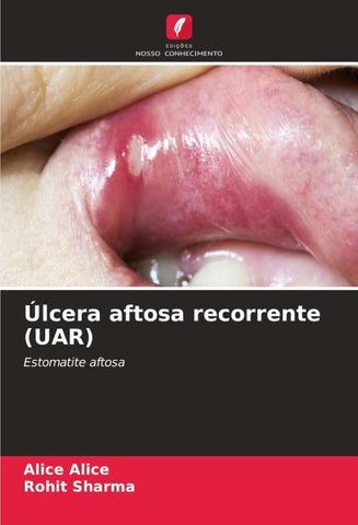 Úlcera aftosa recorrente (UAR)