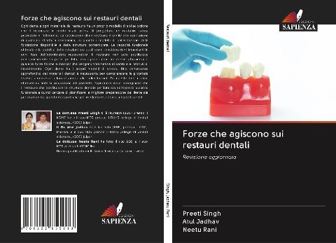 Forze che agiscono sui restauri dentali