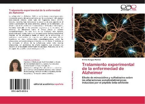 Tratamiento experimental de la enfermedad de Alzheimer