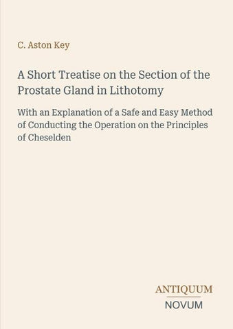 A Short Treatise on the Section of the Prostate Gland in Lithotomy