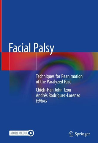 Facial Palsy