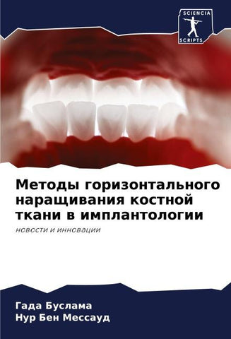 Metody gorizontal'nogo naraschiwaniq kostnoj tkani w implantologii