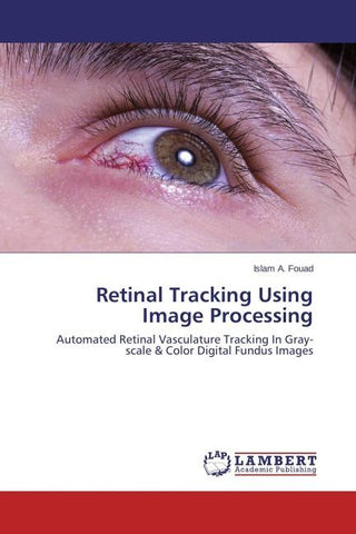 Retinal Tracking Using Image Processing