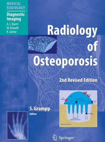 Radiology of Osteoporosis