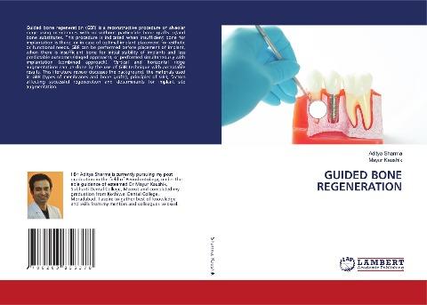 GUIDED BONE REGENERATION
