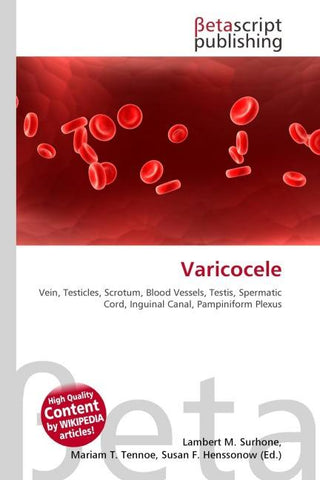 Varicocele