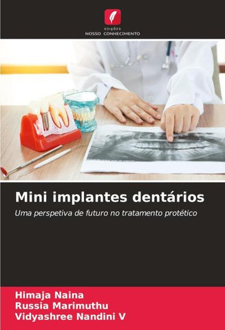 Mini implantes dentários