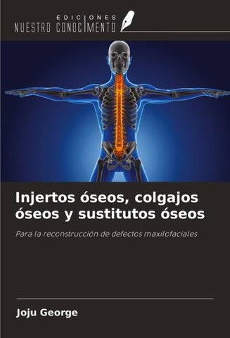 Injertos óseos, colgajos óseos y sustitutos óseos