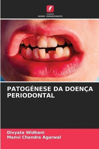 PATOGÉNESE DA DOENÇA PERIODONTAL