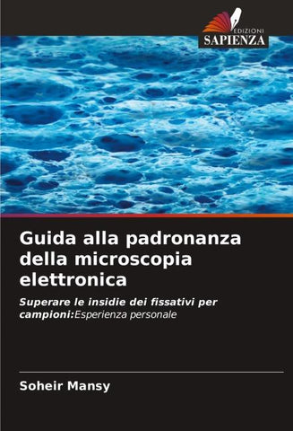 Guida alla padronanza della microscopia elettronica