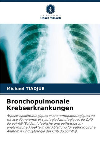 Bronchopulmonale Krebserkrankungen
