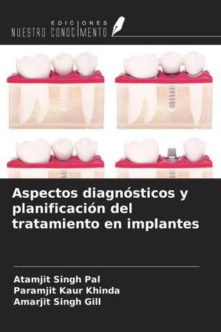 Aspectos diagnósticos y planificación del tratamiento en implantes