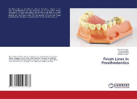Finish Lines In Prosthodontics