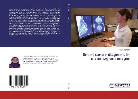 Breast cancer diagnosis in mammogram images