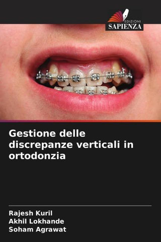 Gestione delle discrepanze verticali in ortodonzia