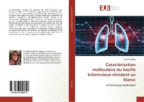 Caractérisation moléculaire du bacille tuberculeux circulant au Maroc