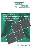 Hierarchic Recognition of Tumors in Chest Radiographs with Computer