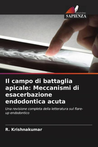 Il campo di battaglia apicale: Meccanismi di esacerbazione endodontica acuta