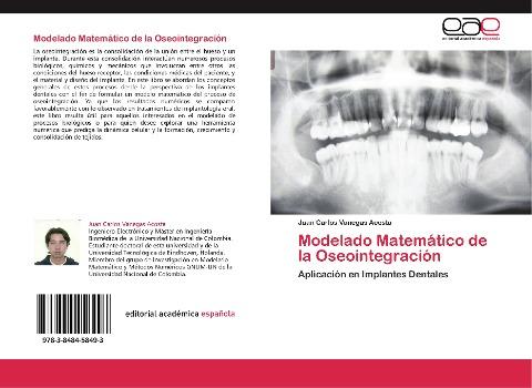 Modelado Matemático de la Oseointegración