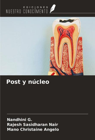 Post y núcleo