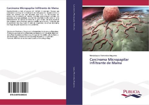 Carcinoma Micropapilar Infiltrante de Mama