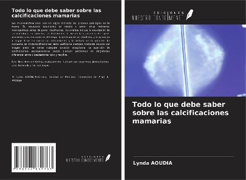 Todo lo que debe saber sobre las calcificaciones mamarias