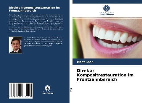 Direkte Kompositrestauration im Frontzahnbereich