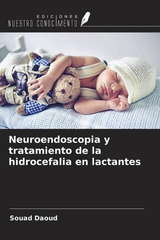 Neuroendoscopia y tratamiento de la hidrocefalia en lactantes