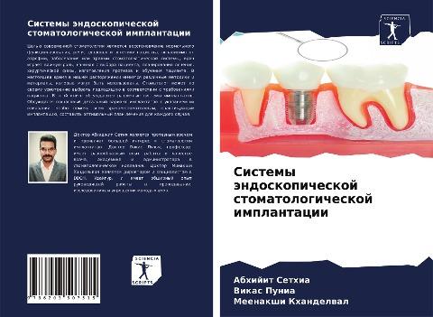 Sistemy ändoskopicheskoj stomatologicheskoj implantacii