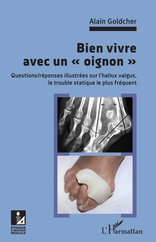 Bien vivre avec un "oignon"