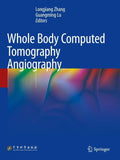 Whole Body Computed Tomography Angiography