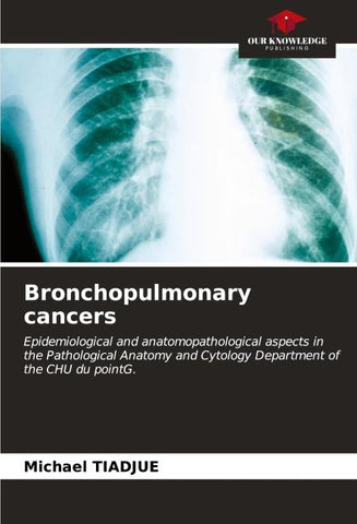 Bronchopulmonary cancers
