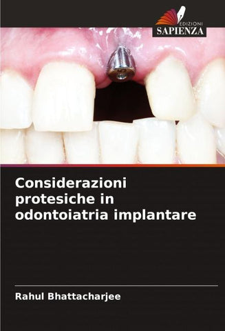 Considerazioni protesiche in odontoiatria implantare