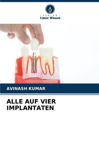 ALLE AUF VIER IMPLANTATEN