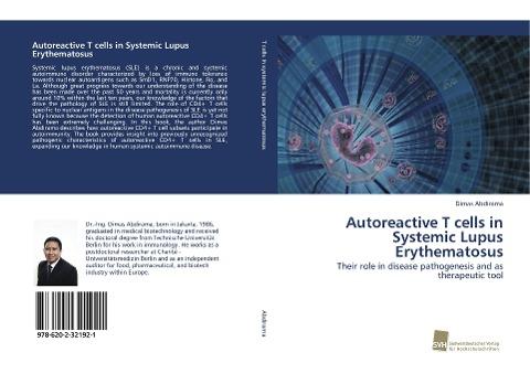 Autoreactive T cells in Systemic Lupus Erythematosus