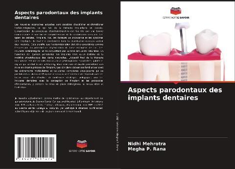 Aspects parodontaux des implants dentaires
