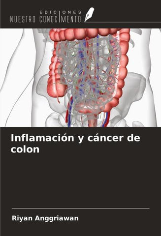 Inflamación y cáncer de colon