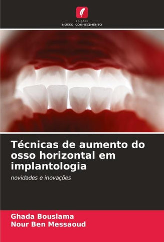 Técnicas de aumento do osso horizontal em implantologia