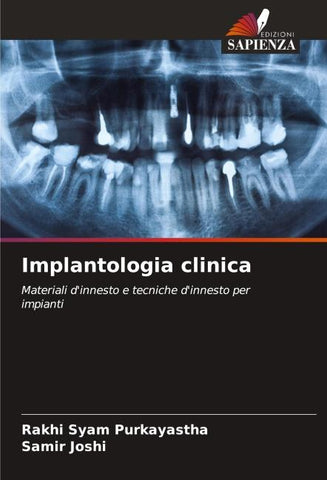 Implantologia clinica