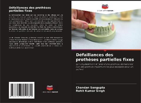 Défaillances des prothèses partielles fixes