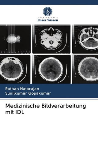 Medizinische Bildverarbeitung mit IDL