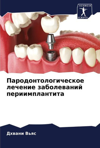 Parodontologicheskoe lechenie zabolewanij periimplantita