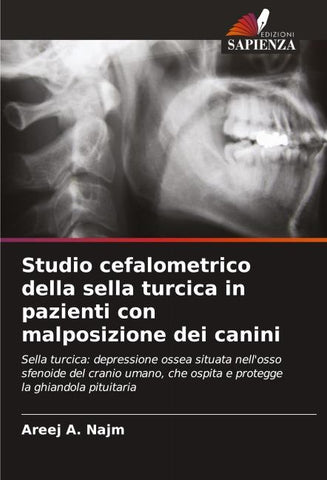 Studio cefalometrico della sella turcica in pazienti con malposizione dei canini