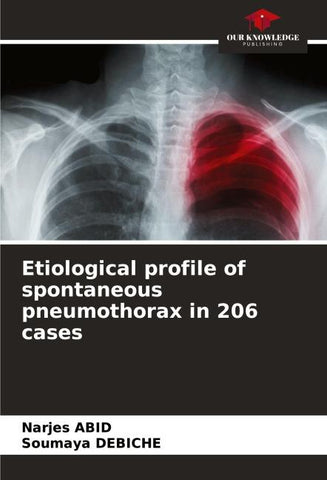 Etiological profile of spontaneous pneumothorax in 206 cases