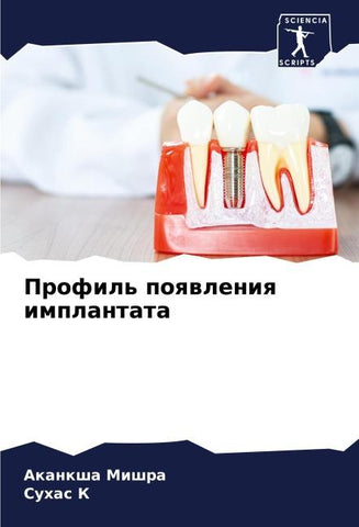 Profil' poqwleniq implantata